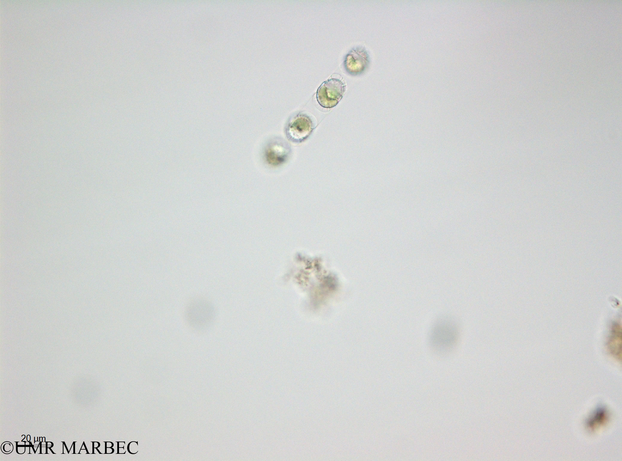 phyto/Thau_Lagoon/THAU_station1/OSU_plancton 2013/Chaetoceros spp (Hypnospores -40x -140110 -3)(copy).jpg